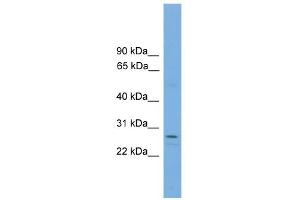 Western Blotting (WB) image for anti-Regulator of Calcineurin 1 (RCAN1) (N-Term) antibody (ABIN2787429)