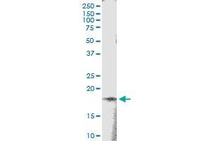 Immunoprecipitation of TSEN15 transfected lysate using anti-TSEN15 MaxPab rabbit polyclonal antibody and Protein A Magnetic Bead , and immunoblotted with TSEN15 MaxPab mouse polyclonal antibody (B01) . (TSEN15 Antikörper  (AA 1-171))