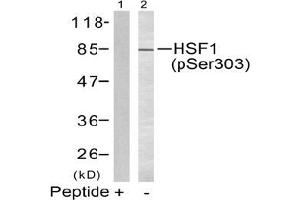 Image no. 2 for anti-Heat Shock Factor Protein 1 (HSF1) (pSer303) antibody (ABIN197025) (HSF1 Antikörper  (pSer303))