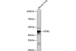 Western blot analysis of extracts of Mouse lung, using DDB2 Rabbit mAb (ABIN7266674) at 1:1000 dilution.