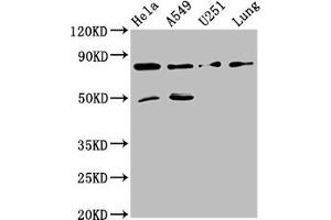Western Blot Positive WB detected in: Hela whole cell lysate, A549 whole cell lysate, U251 whole cell lysate, Mouse lung tissue All lanes: Pcsk1 antibody at 8 μg/mL Secondary Goat polyclonal to rabbit IgG at 1/50000 dilution Predicted band size: 85 kDa Observed band size: 85 kDa (PCSK2 Antikörper  (AA 267-391))