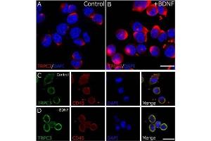 Upregulation of TRPC3 surface expression in rat microglia following BDNF stimulation.