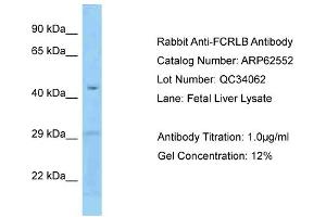 Western Blotting (WB) image for anti-Fc Receptor-Like B (FCRLB) (N-Term) antibody (ABIN2789176)