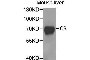 Western blot analysis of extracts of mouse liver, using C9 antibody. (C9 Antikörper)