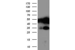 Western Blotting (WB) image for anti-T-Cell Acute Lymphocytic Leukemia 1 (TAL1) antibody (ABIN1501290) (TAL1 Antikörper)