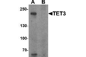 Western blot analysis of TET3 in SK-N-SH cell lysate with TET3 antibody at 1 µg/mL in (A) the absence and (B) the presence of blocking peptide. (TET3 Antikörper  (C-Term))