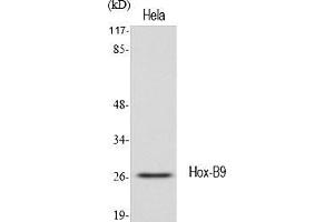 Western Blot analysis of various cells using Hox-B9 Polyclonal Antibody diluted at 1:1000.
