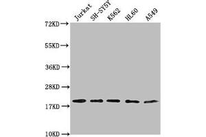 Western Blot Positive WB detected in: Jurkat whole cell lysate, SH-SY5Y whole cell lysate, K562 whole cell lysate, HL-60 whole cell lysate, A549 whole cell lysate All lanes: RPL24 antibody at 1:2000 Secondary Goat polyclonal to rabbit IgG at 1/50000 dilution Predicted band size: 18 kDa Observed band size: 18 kDa (RPL24 Antikörper  (AA 1-157))