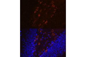 Immunofluorescence analysis of mouse brain using Phospho-Tau-T231 antibody (ABIN7268531). (MAPT Antikörper  (pThr231))