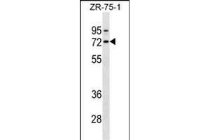 SELE Antibody (Ascites) ABIN1539992 western blot analysis in ZR-75-1 cell line lysates (35 μg/lane). (Selectin E/CD62e Antikörper)