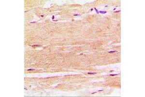 Immunohistochemistry (IHC) image for anti-Sphingosine Kinase 1 (SPHK1) antibody (ABIN7308364) (SPHK1 Antikörper)