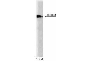 Western blot analysis of PKCepsilon on rat brain lysate. (PKC epsilon Antikörper  (AA 1-175))