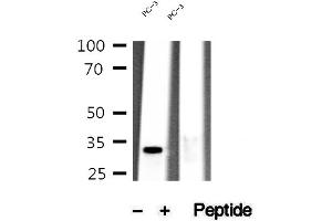 Western blot analysis of extracts of PC-3 cells, using MEST antibody.