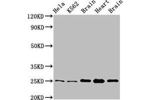 Western Blot Positive WB detected in: Hela whole cell lysate, K562 whole cell lysate, Rat brain tissue, Rat heart tissue, Mouse brain tissu All lanes: SOD2 antibody at 3. (SOD2 Antikörper  (AA 64-175))