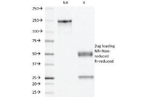 SDS-PAGE Analysis Purified PR Monoclonal Antibody (PR501). (Progesterone Receptor Antikörper)