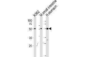 Western blot analysis of lysates from K562 cell line, mouse small intestine, rat stomach tissue lysate(from left to right), using Frk Antibody (C-term) (ABIN6243248 and ABIN6577654). (FRK Antikörper  (C-Term))