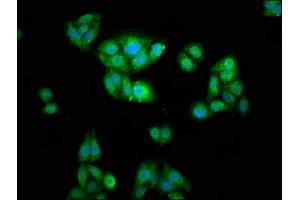 Immunofluorescence staining of HepG2 cells with ABIN7175834 at 1:166, counter-stained with DAPI. (WASF2 Antikörper  (AA 243-317))