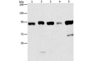 Western Blot analysis of Raji and 231 cell, hepG2, hela and 293T cell using IMMT Polyclonal Antibody at dilution of 1:270 (IMMT Antikörper)