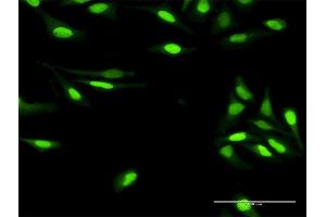 Immunofluorescence of purified MaxPab antibody to DDB2 on HeLa cell. (DDB2 Antikörper  (AA 1-427))