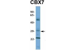 Host:  Rabbit  Target Name:  CBX7  Sample Type:  Human Fetal Muscle  Antibody Dilution:  1. (CBX7 Antikörper  (Middle Region))