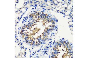 Immunohistochemistry of paraffin-embedded mouse lung using FKBP12 antibody (ABIN3022503, ABIN3022504, ABIN3022505 and ABIN6218864) at dilution of 1:200 (40x lens). (FKBP1A Antikörper  (AA 1-108))