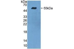Detection of Recombinant ITGa9, Human using Polyclonal Antibody to Integrin Alpha 9 (ITGa9) (ITGA9 Antikörper  (AA 741-965))