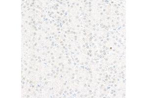 Immunohistochemistry (IHC) image for anti-Replication Protein A2, 32kDa (RPA2) (C-Term) antibody (ABIN7454599) (RPA2 Antikörper  (C-Term))