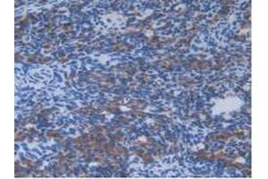 IHC-P analysis of Mouse Ovary Tissue, with DAB staining. (IL13RA2 Antikörper  (AA 228-338))