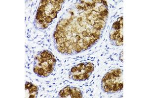 Immunohistochemistry of paraffin-embedded human colon using TFF3 Rabbit mAb (ABIN1680916, ABIN3019077, ABIN3019078 and ABIN7101711) at dilution of 1:100 (40x lens). (TFF3 Antikörper)