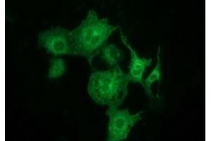 Anti-MTMR14 mouse monoclonal antibody (ABIN2453860) immunofluorescent staining of COS7 cells transiently transfected by pCMV6-ENTRY MTMR14 (RC207732). (MTMR14 Antikörper)