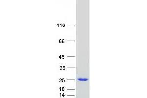 Western Blotting (WB) image for Calcyphosine (CAPS) (Transcript Variant 1) protein (Myc-DYKDDDDK Tag) (ABIN2713046)
