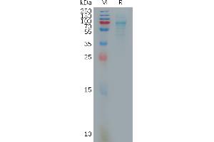 Human C Protein, hFc Tag on SDS-PAGE under reducing condition.