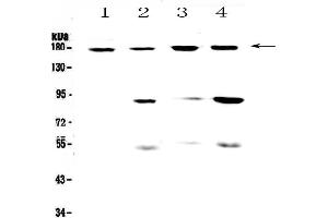 Western blot analysis of CD11b using anti-CD11b antibody . (CD11b Antikörper  (AA 129-336))