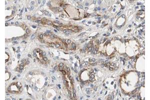 ABIN6267492 at 1/100 staining human Kidney tissue sections by IHC-P. (VEGFR2/CD309 Antikörper  (pTyr951))