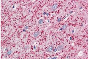 Human Brain, Cortex (formalin-fixed, paraffin-embedded) stained with MOG antibody ABIN337146 at 5 ug/ml followed by biotinylated anti-goat IgG secondary antibody ABIN481715, alkaline phosphatase-streptavidin and chromogen. (MOG Antikörper  (AA 248-259))