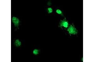 Anti-ACD mouse monoclonal antibody (ABIN2455628) immunofluorescent staining of COS7 cells transiently transfected by pCMV6-ENTRY ACD (RC204381). (ACD Antikörper)