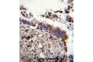 TTBK2 Antibody (N-term) immunohistochemistry analysis in formalin fixed and paraffin embedded human lung tissue followed by peroxidase conjugation of the secondary antibody and DAB staining.