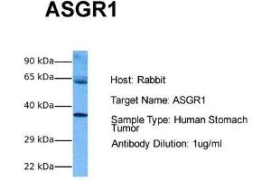 Host: Rabbit Target Name: ASGR1 Sample Tissue: Human Stomach Tumor Antibody Dilution: 1. (Asialoglycoprotein Receptor 1 Antikörper  (Middle Region))