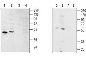 Western blot analysis of rat kidney (lanes 1 and 3), rat heart (lanes 2 and 4), human SH-SY5Y brain neuroblastoma (lanes 5 and 7) and Human MS-1  neuroendocrine skin carcinoma cell (lanes 6 and 8) lysates: - 1,2,5,6. (S1PR2 Antikörper  (2nd Cytoplasmic Loop))