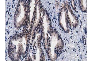 Image no. 4 for anti-Transforming, Acidic Coiled-Coil Containing Protein 3 (TACC3) antibody (ABIN1498095) (TACC3 Antikörper)