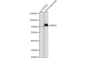 Western blot analysis of extracts of various cell lines, using RIOK3 antibody (ABIN7270112) at 1:1000 dilution. (RIOK3 Antikörper  (AA 200-519))