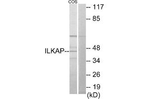 Western blot analysis of extracts from COS-7 cells, using ILKAP antibody. (ILKAP Antikörper  (Internal Region))