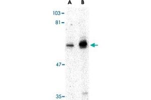 Western blot analysis of PTPN11 in mouse skeletal muscle tissue lysate with PTPN11 polyclonal antibody  at (A) 0. (PTPN11 Antikörper  (N-Term))