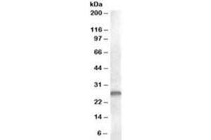 Western blot testing of human kidney lysate with CLEC1B antibody at 1ug/ml. (C-Type Lectin Domain Family 1, Member B (CLEC1B) Antikörper)