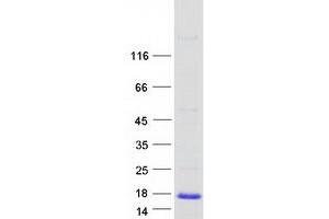 Western Blotting (WB) image for Microseminoprotein, Prostate Associated (MSMP) protein (Myc-DYKDDDDK Tag) (ABIN2725991)