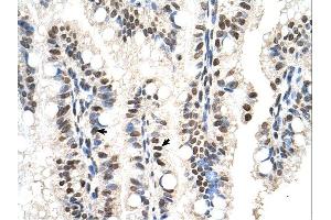RUNDC2A antibody was used for immunohistochemistry at a concentration of 4-8 ug/ml. (SNX29 Antikörper  (N-Term))