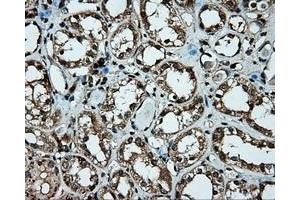 Immunohistochemical staining of paraffin-embedded liver tissue using anti-PLEK mouse monoclonal antibody. (Pleckstrin Antikörper)