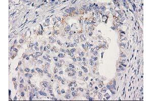 Image no. 1 for anti-Mitochondrial Ribosomal Protein S2 (MRPS2) antibody (ABIN1499562) (MRPS2 Antikörper)