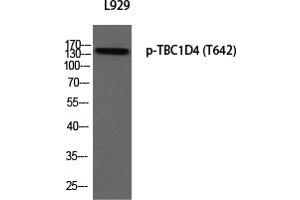 Western Blotting (WB) image for anti-TBC1 Domain Family, Member 4 (TBC1D4) (pThr642) antibody (ABIN5955761) (TBC1D4 Antikörper  (pThr642))