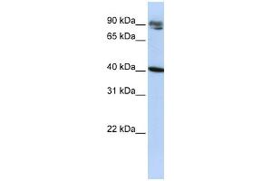 WB Suggested Anti-KLHDC8A Antibody Titration:  0. (KLHDC8A Antikörper  (Middle Region))